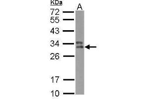 WB Image Sample (30 ug of whole cell lysate) A: Raji 12% SDS PAGE antibody diluted at 1:500 (HLA-DPB1 antibody)