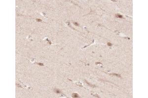 ABIN6266663 at 1/100 staining human brain tissue sections by IHC-P. (TNFRSF1A antibody  (C-Term))