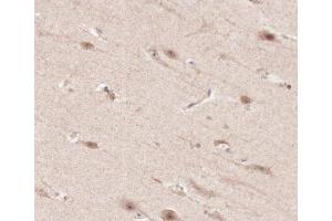 Immunohistochemistry (IHC) image for anti-Tumor Necrosis Factor Receptor Superfamily, Member 1A (TNFRSF1A) (C-Term) antibody (ABIN6265634)