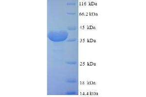 SDS-PAGE (SDS) image for FK506 Binding Protein 14, 22 KDa (FKBP14) (AA 20-211) protein (His-SUMO Tag) (ABIN5711793)
