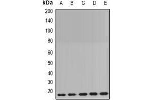 Western blot analysis of Cyclophilin B expression in MCF7 (A), HepG2 (B), mouse brain (C), mouse lung (D), rat liver (E) whole cell lysates. (PPIB antibody)