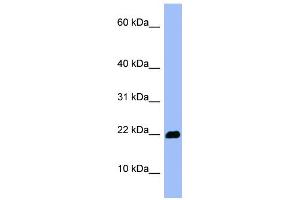 WB Suggested Anti-OMP Antibody Titration: 0.