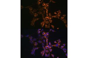 Immunofluorescence analysis of NIH-3T3 cells using Septin 4 Polyclonal Antibody (ABIN6128476, ABIN6147554, ABIN6147555 and ABIN6214410) at dilution of 1:100 (40x lens). (Septin 4 antibody  (AA 1-100))