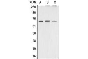 Western blot analysis of AMPK alpha 1/2 expression in HeLa (A), mouse brain (B), rat brain (C) whole cell lysates. (PRKAA1/PRKAA2 antibody  (Center))