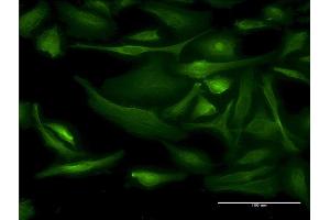 Immunofluorescence of monoclonal antibody to BNIP1 on HeLa cell. (BNIP1 antibody  (AA 1-228))