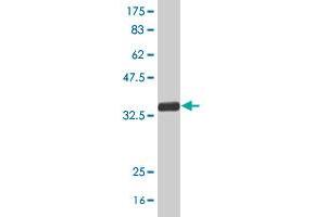 Western Blot detection against Immunogen (34. (SFRS6 antibody  (AA 1-75))