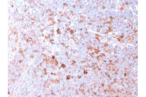 Immunohistochemistry (IHC) image for anti-CD40 Ligand (CD40LG) (AA 108-261) antibody (ABIN6941188)