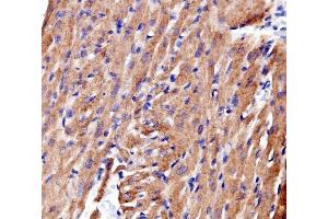 IHC analysis of ACTN2 using anti-ACTN2 antibody (ABIN7602055). (ACTN2 antibody  (AA 567-696))
