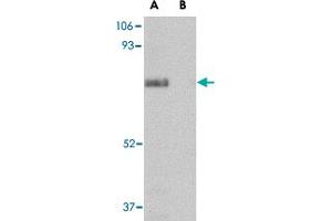 Western blot analysis of SCARB2 in human skeletal muscle tissue lysate with SCARB2 polyclonal antibody  at 1 ug/mL in (A) the absence and (B) presence of blocking peptide. (SCARB2 antibody  (Internal Region))