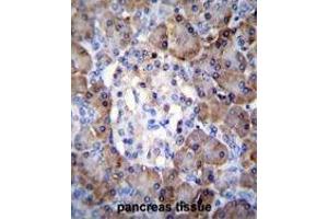 TIMP1 Antibody (C-term) immunohistochemistry analysis in formalin fixed and paraffin embedded human pancreas tissue followed by peroxidase conjugation of the secondary antibody and DAB staining.