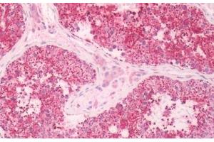 Human Testis: Formalin-Fixed, Paraffin-Embedded (FFPE) (KISS1R antibody  (Extracellular Domain))
