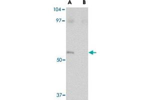 Western blot analysis of LASS5 in SK-N-SH lysate with LASS5 polyclonal antibody  at 1 ug/mL in the (A) absence and (B) presence of blocking peptide. (LASS5 antibody  (C-Term))