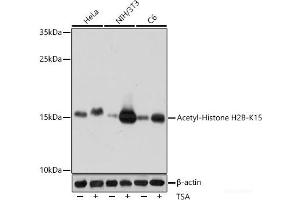 Western blot analysis of extracts of various cell lines using Acetyl-Histone H2B-K15 Polyclonal Antibody at dilution of 1:1000. (Histone H2B antibody  (acLys15))