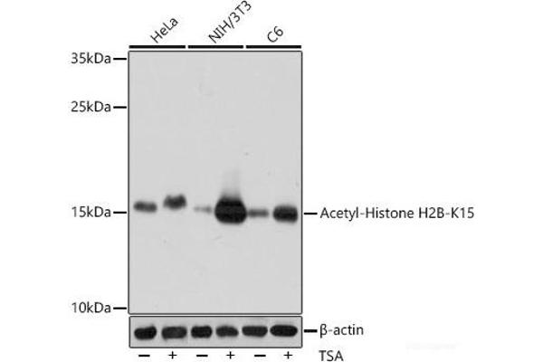 Histone H2B 抗体  (acLys15)