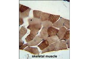 ST3GAL5 antibody immunohistochemistry analysis in formalin fixed and paraffin embedded human skeletal muscle followed by peroxidase conjugation of the secondary antibody and DAB staining. (ST3GAL5 antibody  (C-Term))