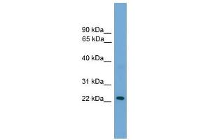 RAB39 antibody used at 1 ug/ml to detect target protein.