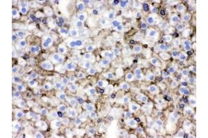 Immunohistochemistry (IHC) image for anti-Solute Carrier Family 10 (Sodium/bile Acid Cotransporter Family), Member 1 (SLC10A1) antibody (ABIN4951952)