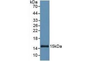 Detection of Recombinant SAA, Human using Monoclonal Antibody to Serum Amyloid A (SAA) (SAA antibody  (AA 19-122))