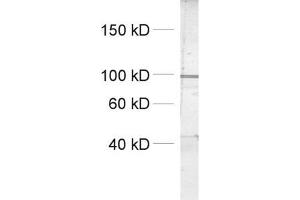 dilution: 1 : 1000, sample: crude synaptosomal fraction of rat brain (P2) (Dynamin 1, 2, 3 (AA 2-17) antibody)