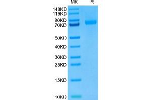 Mouse LRRC15 on Tris-Bis PAGE under reduced condition. (LRRC15 Protein (AA 22-536) (His tag))