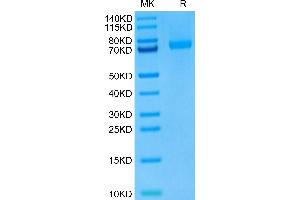 Mouse LRRC15 on Tris-Bis PAGE under reduced condition. (LRRC15 Protein (AA 22-536) (His tag))