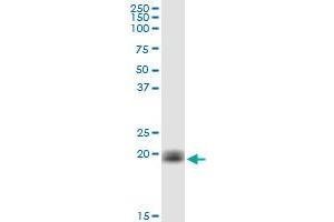 Western Blotting (WB) image for anti-Cytochrome B5 Type B (Outer Mitochondrial Membrane) (CYB5B) (AA 1-146) antibody (ABIN529305)
