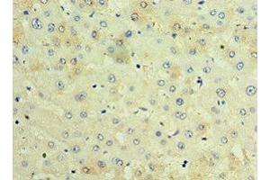 Immunohistochemistry of paraffin-embedded human liver tissue using ABIN7171674 at dilution of 1:100 (TCTN2 antibody  (AA 420-670))