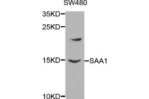 Western blot analysis of extracts of SW480 cells, using SAA1 antibody (ABIN5970819) at 1/1000 dilution. (SAA1 antibody)