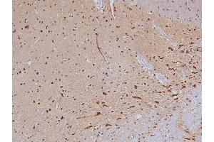 ABIN6267326 at 1/200 staining Rat brain tissue sections by IHC-P.