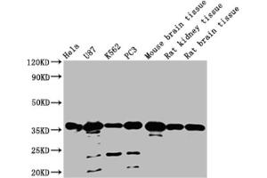 Western blot All lanes: METRNL antibody at 2 μg/mL Lane 1: Mouse small intestine tissue Lane 2: Mouse kidney tissue Lane 3: Rat gonadal tissue Lane 4: Mouse brain tissue Secondary Goat polyclonal to rabbit IgG at 1/10000 dilution Predicted band size: 35, 26 kDa Observed band size: 35 kDa