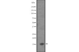 Western blot analysis of IL9 expression in Human fetal liver lysate,The lane on the left is treated with the antigen-specific peptide. (IL-9 antibody  (Internal Region))