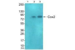 Western blot analysis of extracts from HeLa cells (Lane 2), and A549 cells (Lane 3), using Cox2 antiobdy. (PTGS2 antibody)