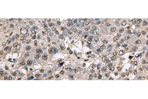 TMX3 antibody