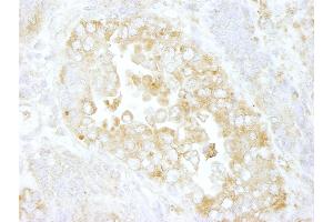 Immunohistochemistry (IHC) image for anti-rho GTPase Activating Protein 1 (ARHGAP1) (AA 1-50) antibody (ABIN7448467) (ARHGAP1 antibody  (AA 1-50))