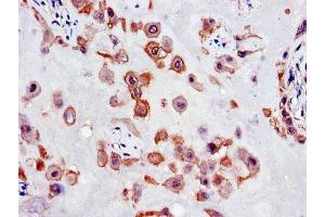 Immunohistochemistry of paraffin-embedded human placenta tissue using ABIN7147677 at dilution of 1:100 (SLC18A1 antibody  (AA 66-120))