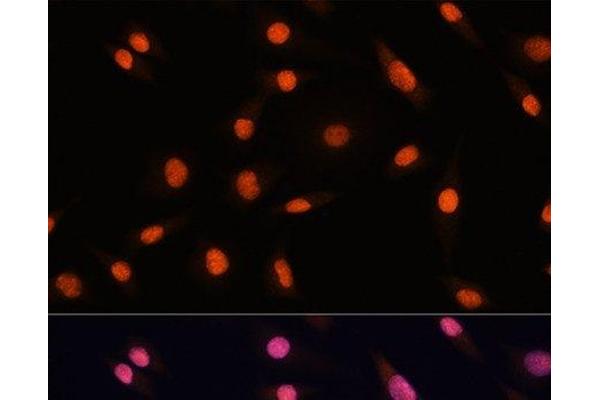 CHD4 antibody