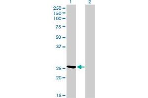 Image no. 1 for anti-Chloride Intracellular Channel 3 (CLIC3) (AA 137-237) antibody (ABIN465974) (CLIC3 antibody  (AA 137-237))