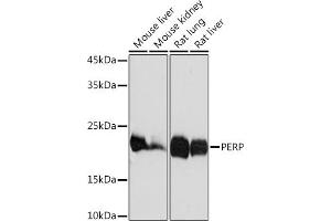Western blot analysis of extracts of various cell lines, using PERP Rabbit mAb (ABIN7270861) at 1:1000 dilution. (PERP antibody)