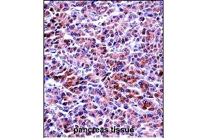 PRSS2 Antibody (Center) ((ABIN657641 and ABIN2846637))immunohistochemistry analysis in formalin fixed and paraffin embedded human pancreas tissue followed by peroxidase conjugation of the secondary antibody and DAB staining. (PRSS2 antibody  (AA 80-108))