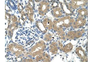 ADH4 antibody was used for immunohistochemistry at a concentration of 4-8 ug/ml.