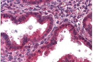 Human Uterus, Endometrium (formalin-fixed, paraffin-embedded) stained with DCN antibody ABIN298189 at 2. (Decorin antibody)