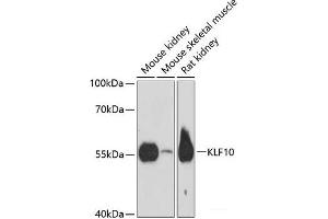 Western blot analysis of extracts of various cell lines using KLF10 Polyclonal Antibody at dilution of 1:3000. (KLF10/TIEG1 antibody)