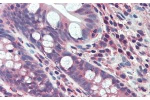 Immunohistochemistry (IHC) image for anti-Fibroblast Growth Factor 15 (FGF15) (AA 25-218) antibody (ABIN7444049)