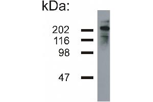 Western blotting analysis of neurofilament heavy protein in porcine brain lysate (reducing conditions) by mouse monoclonal NF-05 . (NEFH antibody)