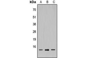 Western blot analysis of SH2D1A expression in HEK293T (A), Raw264. (SH2D1A antibody  (Center))
