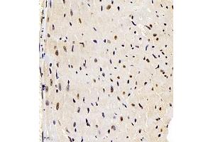 Immunohistochemistry of paraffin embedded mouse heart using smad62024 (ABIN7075629) at dilution of 1:1000 (400x lens) (SMAD6 antibody)