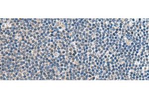 Immunohistochemistry of paraffin-embedded Human tonsil tissue using CNTN4 Polyclonal Antibody at dilution of 1:65(x200) (Contactin 4 antibody)