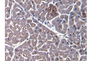 DAB staining on IHC-P; Samples: Bovine Cardiac Muscle Tissue (Myoglobin antibody  (AA 1-154))