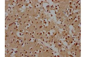 IHC image of ABIN7164625 diluted at 1:100 and staining in paraffin-embedded human brain tissue performed on a Leica BondTM system.