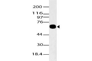 Image no. 1 for anti-K(lysine) Acetyltransferase 5 (KAT5) (AA 300-500) antibody (ABIN5027564)